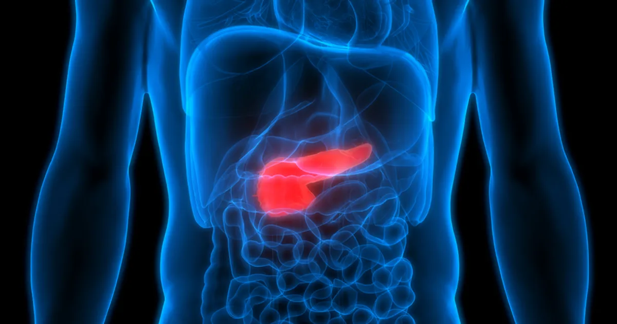 The Facts About Pancreatic Cancer - Nation.com