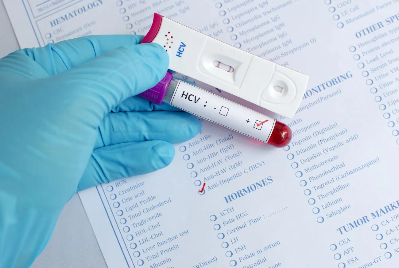 Seniors at High Risk of Hep C: What You Need to Know