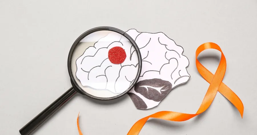 Multiple Sclerosis: Understanding Symptoms and Treatment Options