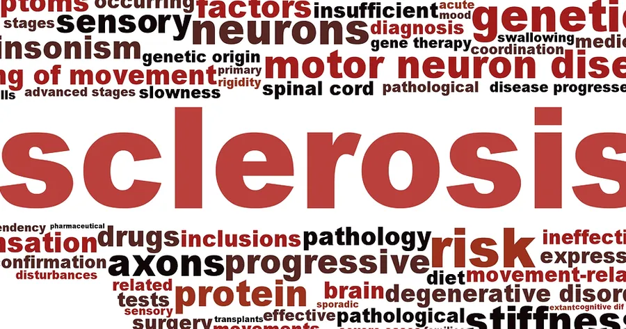 What to Know About Multiple Sclerosis