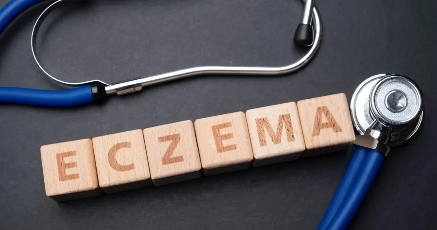 Eczema: The Facts You Need to Know