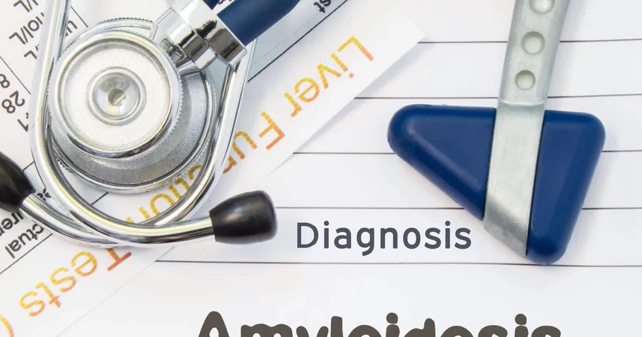 Amyloidosis: What Are the Risk Factors, Symptoms, and Treatment Options?