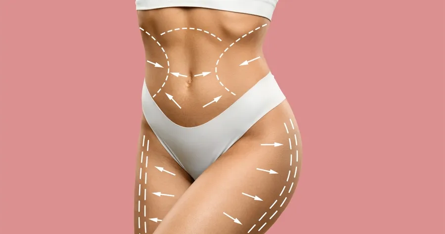 Latest Techniques in Body Contouring After Major Weight Loss