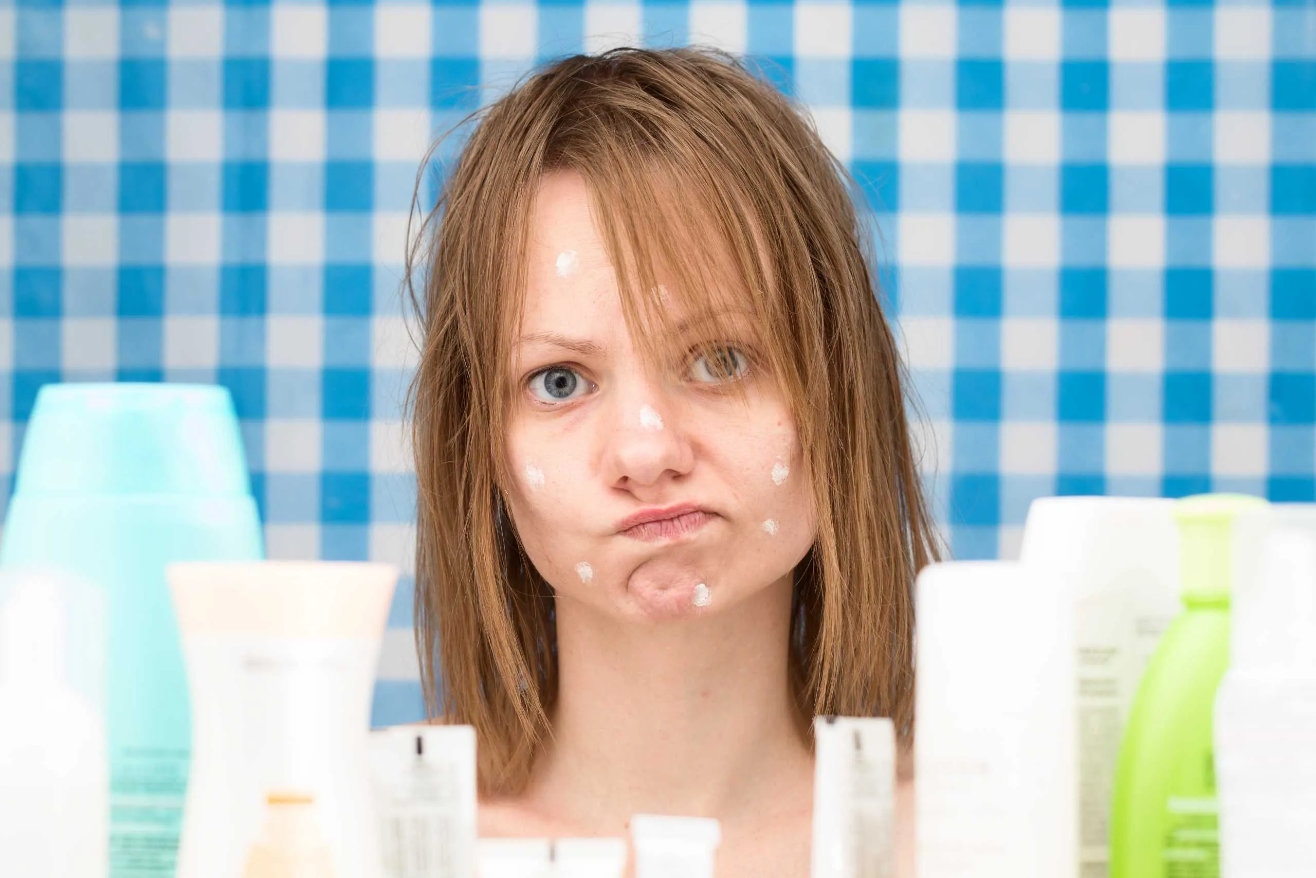 Everything You Need to Know About Acne