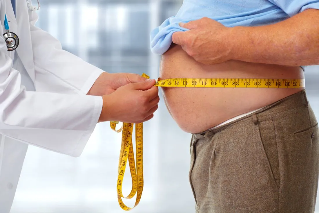 Everything to Know About Obesity