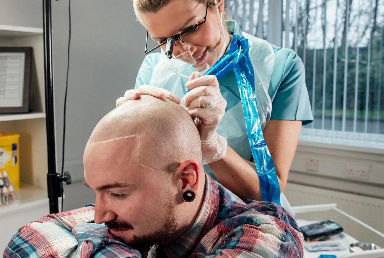 Scalp Micropigmentation: Everything You Need to Know