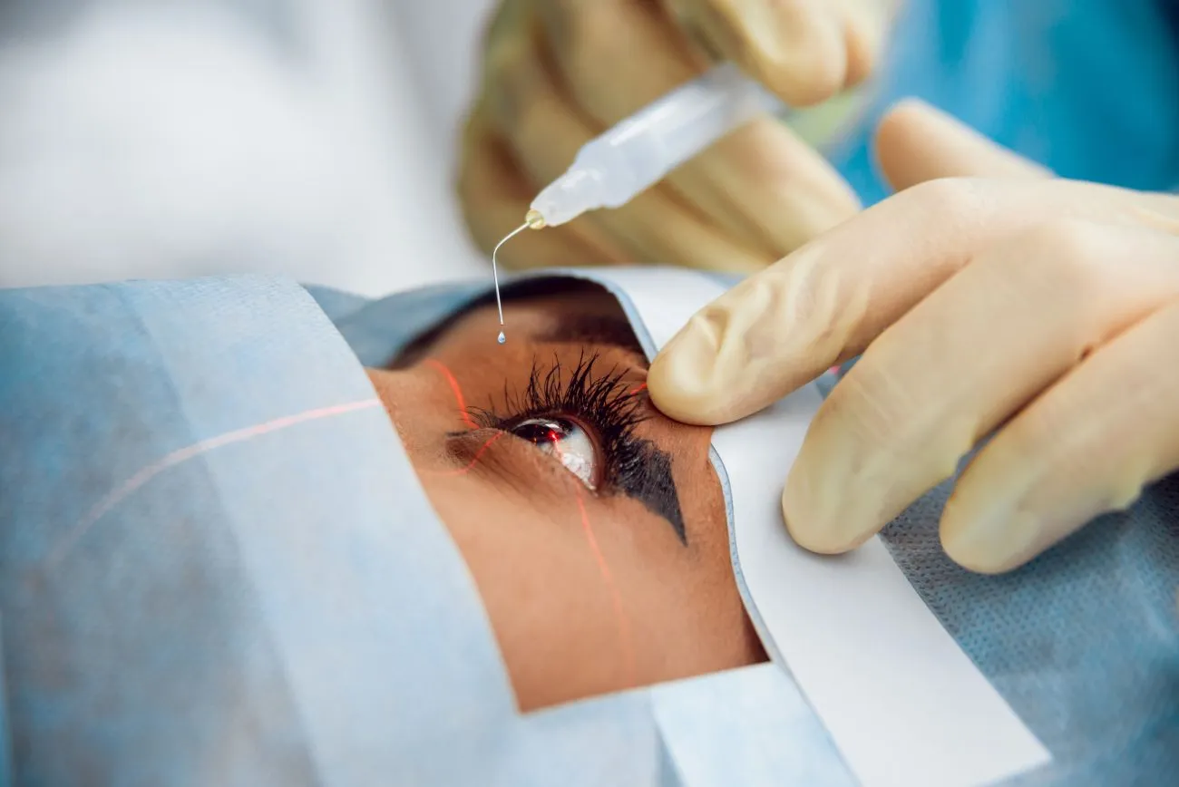 What You Need to Know About Cataract Surgery