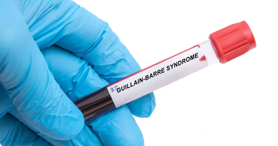 Understanding Guillain-Barré Syndrome: Causes, Symptoms, and Treatment