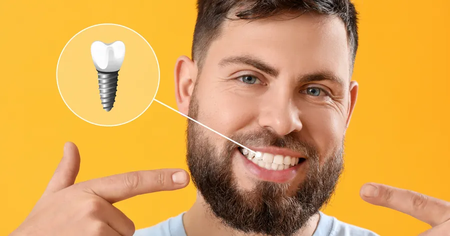 Dental Implants: A Natural Choice for Lasting Oral Health and Quality of Life