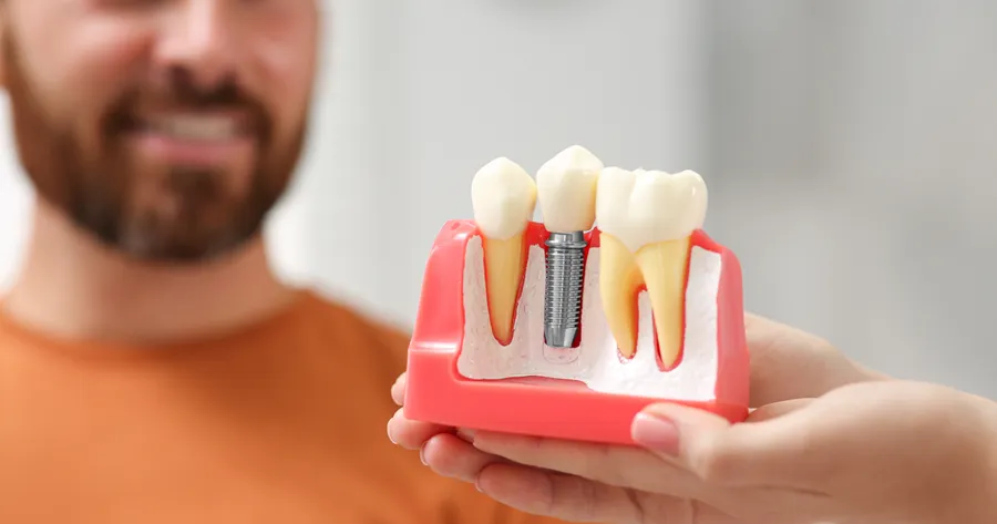 Dental Implants: Your Pathway to a Confident Smile