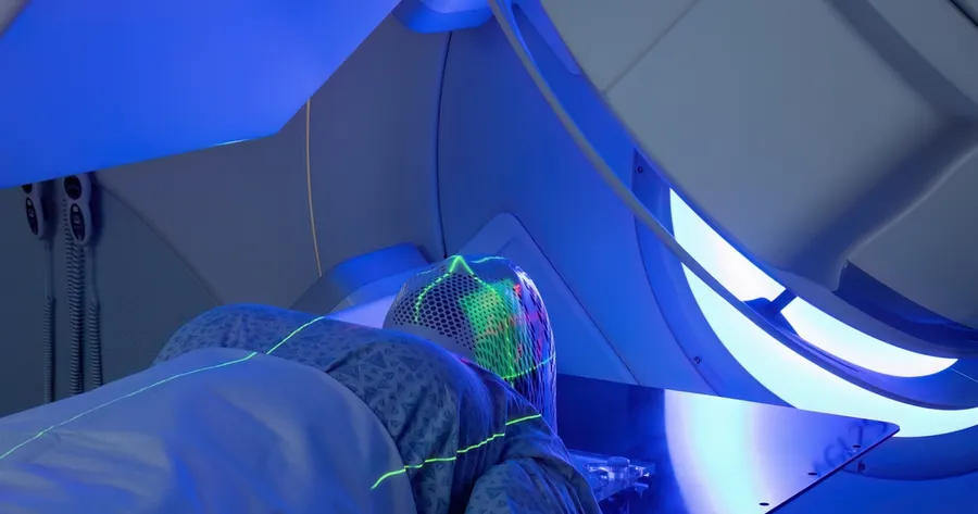 How Is Radiation Therapy Evolving in Cancer Treatment?