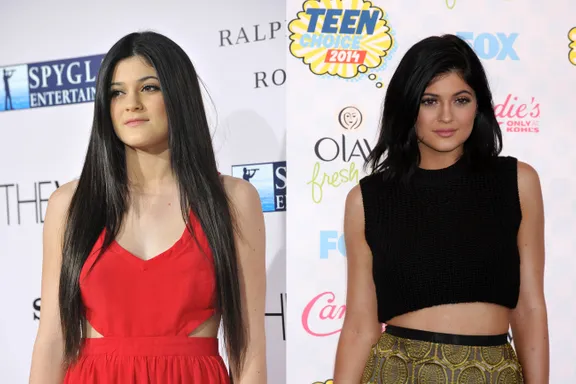 Young Celebrities And Plastic Surgery: Have They Tweaked?