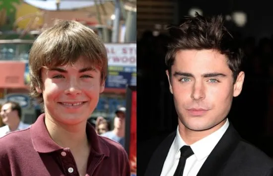 9 Awkward Child Stars Who Became Hot Adults - Fame10
