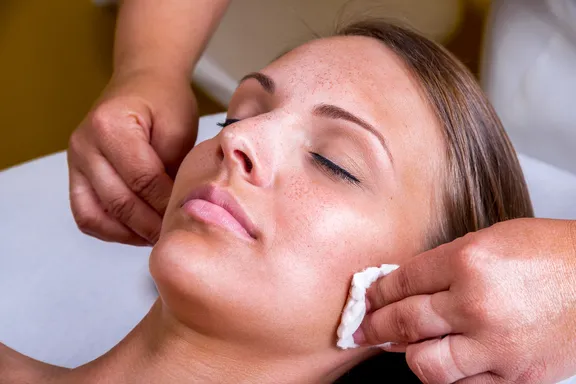 Are Chemical Peels Worth the Cost (And Do They Really Work)?