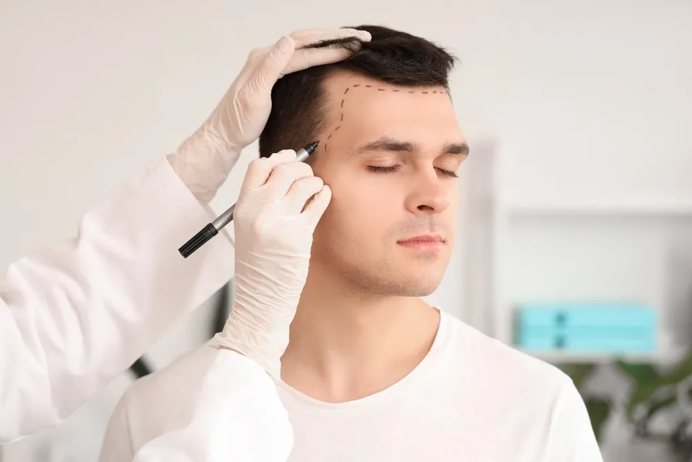 Finding Hair Transplants: Transforming Lives with Lasting Benefits