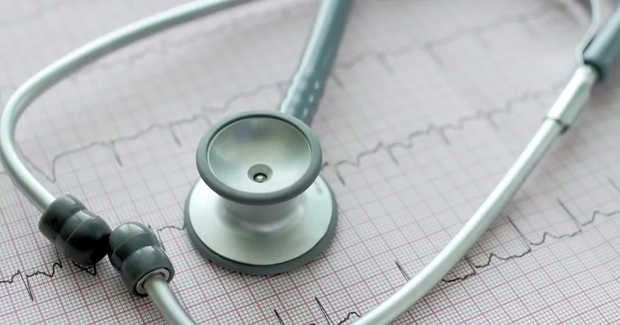 Atrial Fibrillation: Reduce Stroke Risk, Improve Heart Function, Manage Symptoms