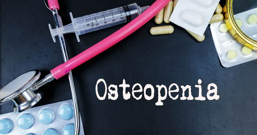 What Are the Treatments for Osteopenia?