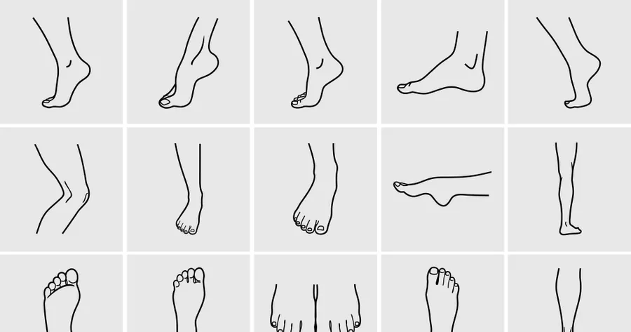 How to Get Rid of Very Sweaty Feet