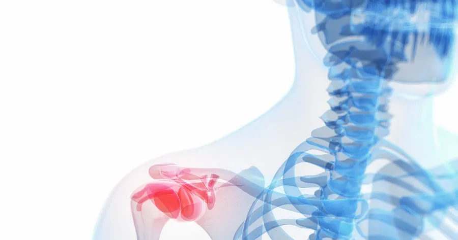 How to Settle a Rotator Cuff Injury