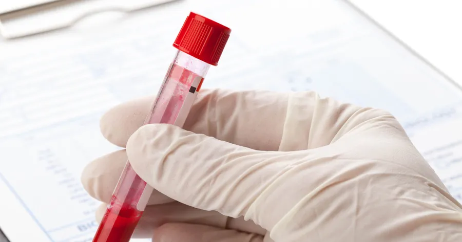 Blood Testing in Red Deer