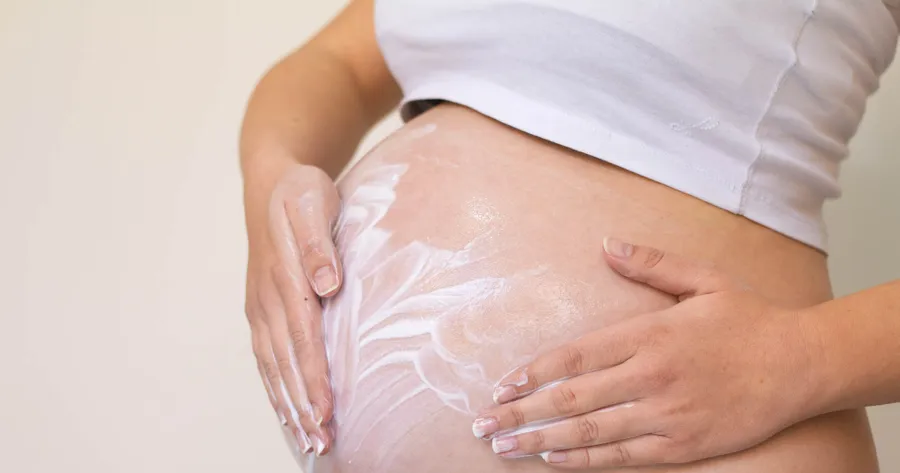 What Are the Treatments for Pregnancy Stretch Marks?