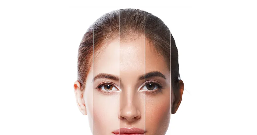 What Are the Causes of Skin Hyperpigmentation?