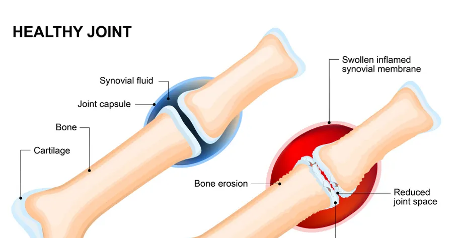 Types of Cartilage