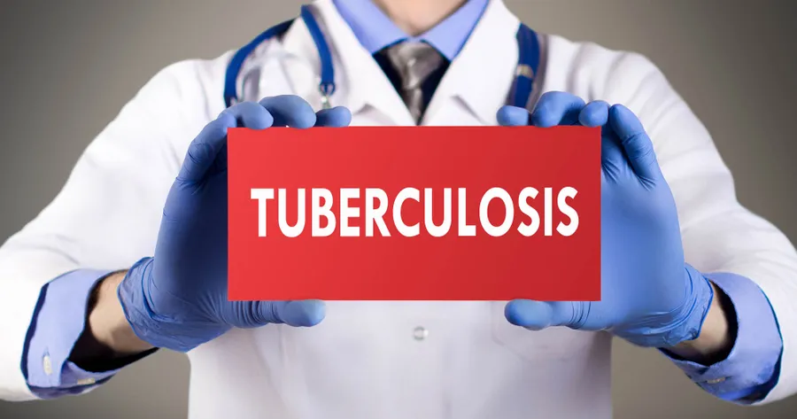 Tubercolosis Treatment