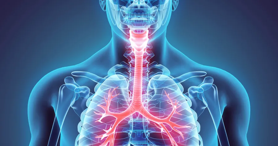 Causes of Respiratory Alkalosis