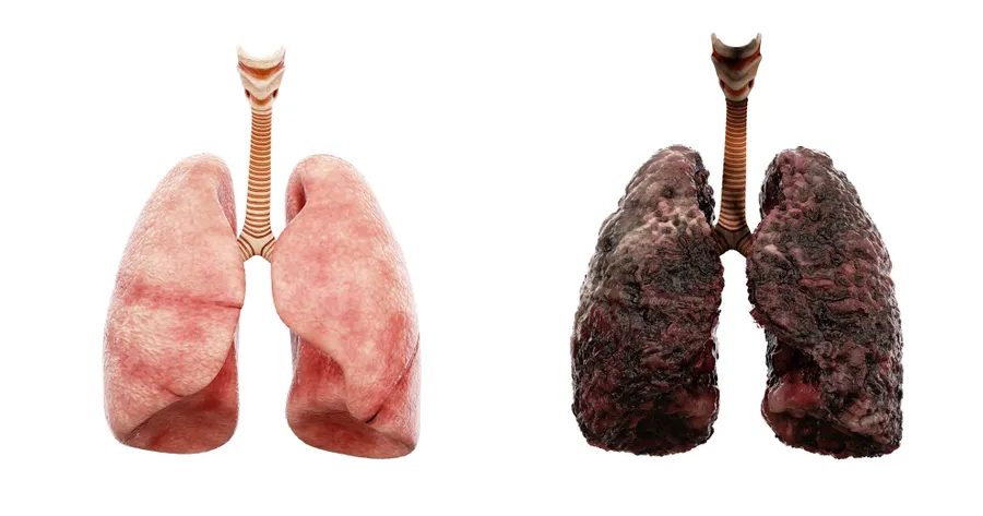 SSA for Lung Disease