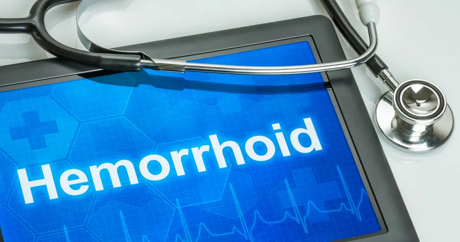 Hemorrhoid Treatments