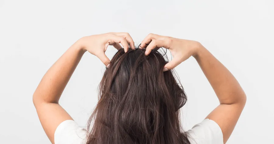 What Are the Causes of Excessive Dry Scalp?