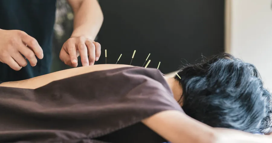 Sciatica Treatment with Acupuncture