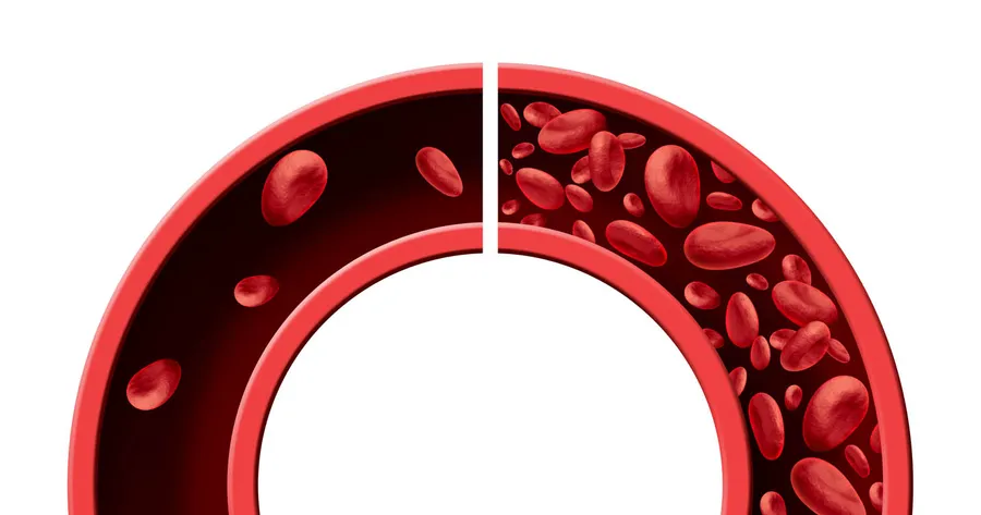 Clinical Symptoms of Anemia