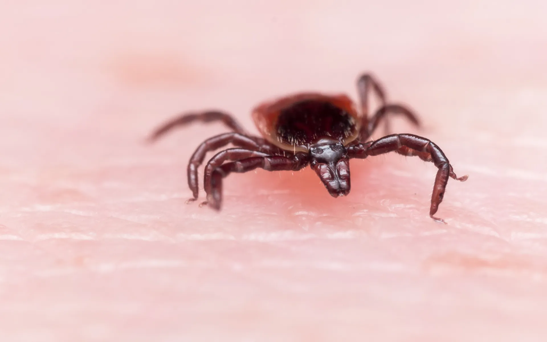 10 Symptoms of Lyme Disease