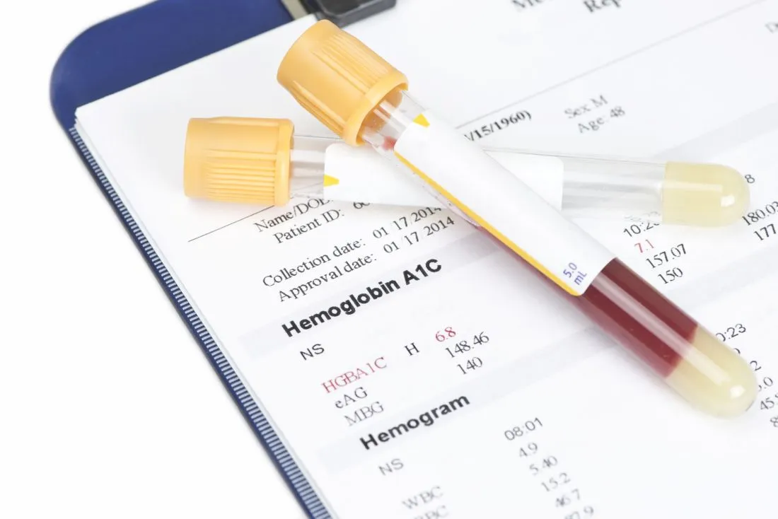 Where Your A1C Levels Need to Be and How to Get Them There