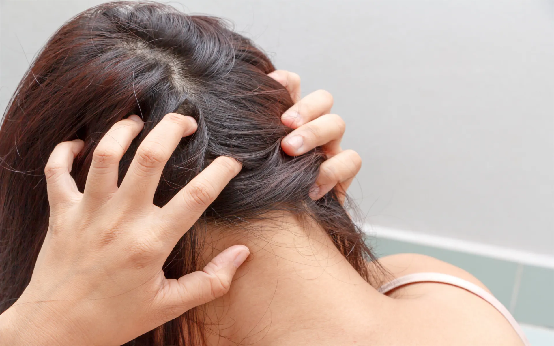 DIY Remedies for Dry/Itchy Scalp