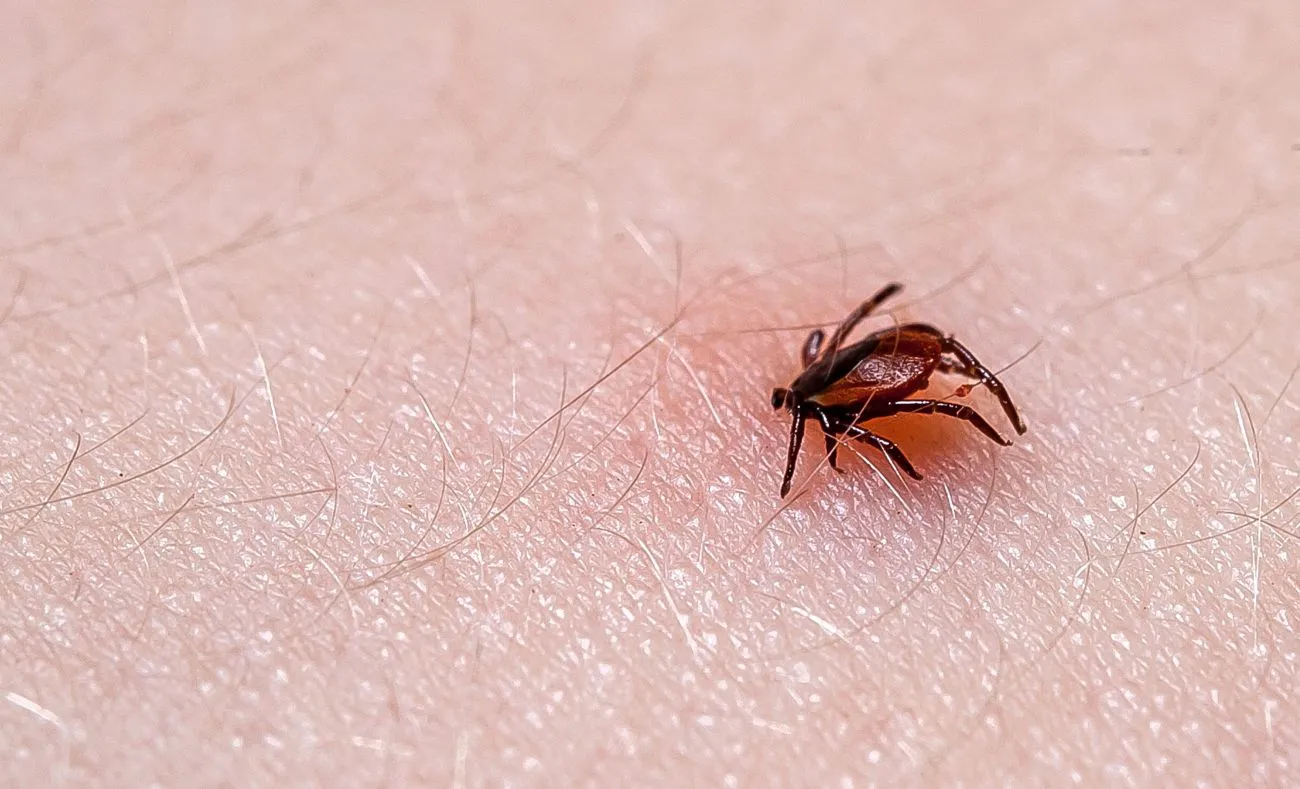 Here’s What You Need to Know about Lyme Disease