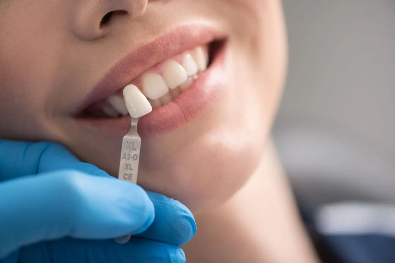 5 Tips for Choosing the Right Implant Dentist
