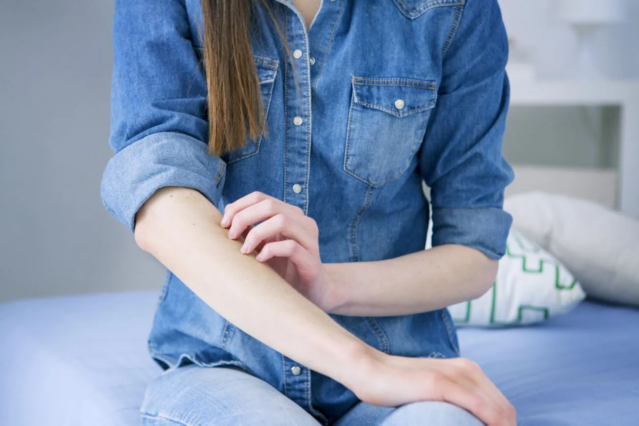 4 Unexpected Eczema Triggers