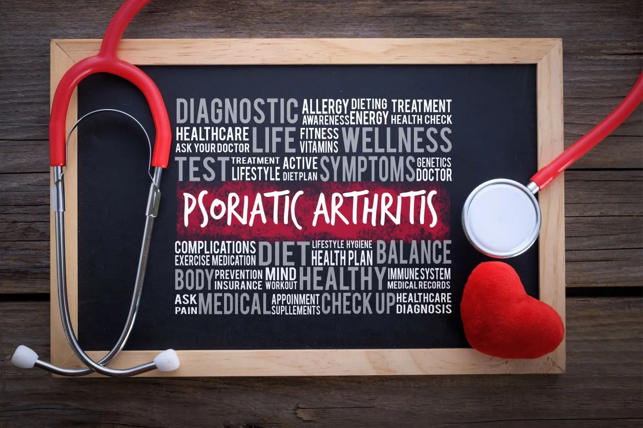 The Connection Between Psoriasis and Arthritis