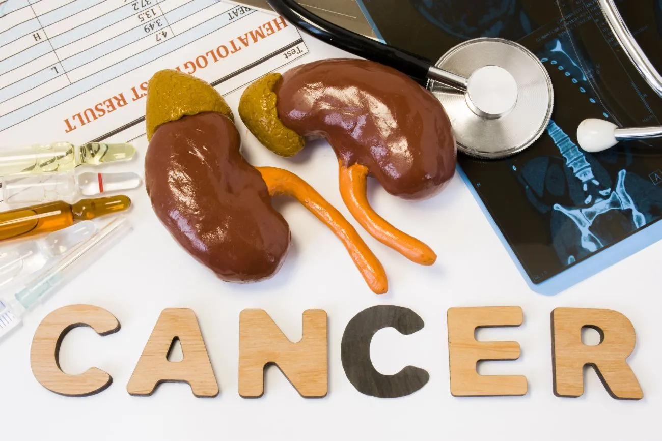 Early Warning Signs of Kidney Cancer and What You Can Do About It