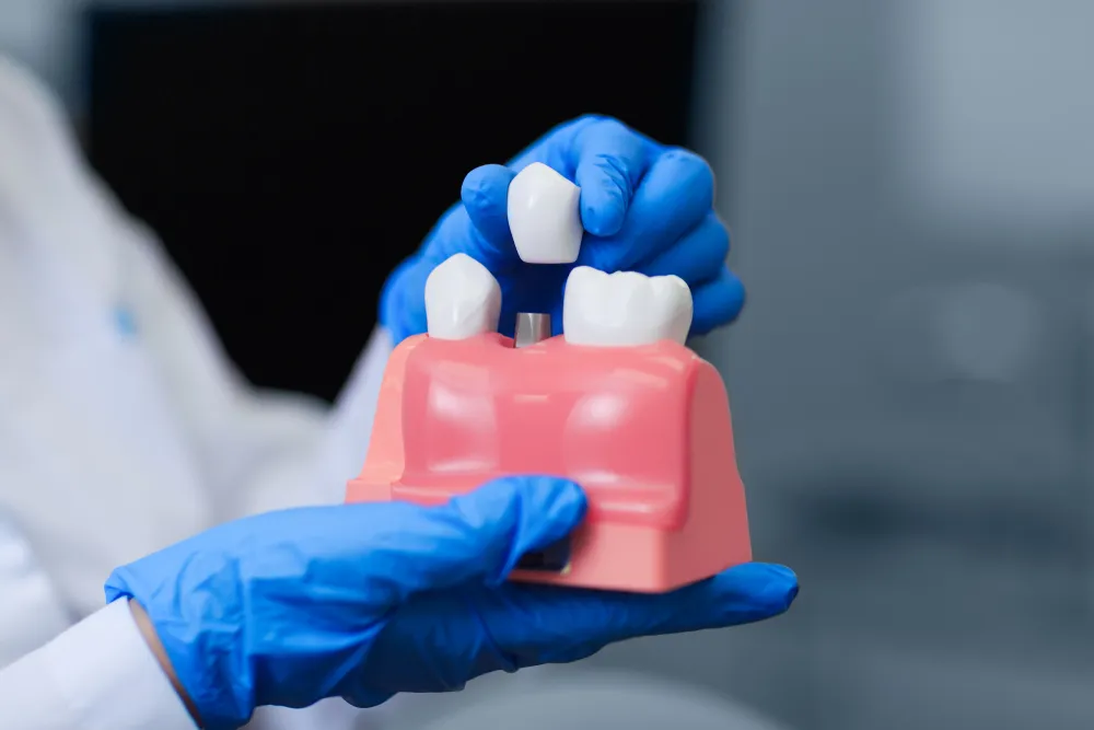 4 Myths About Dental Implants, Debunked