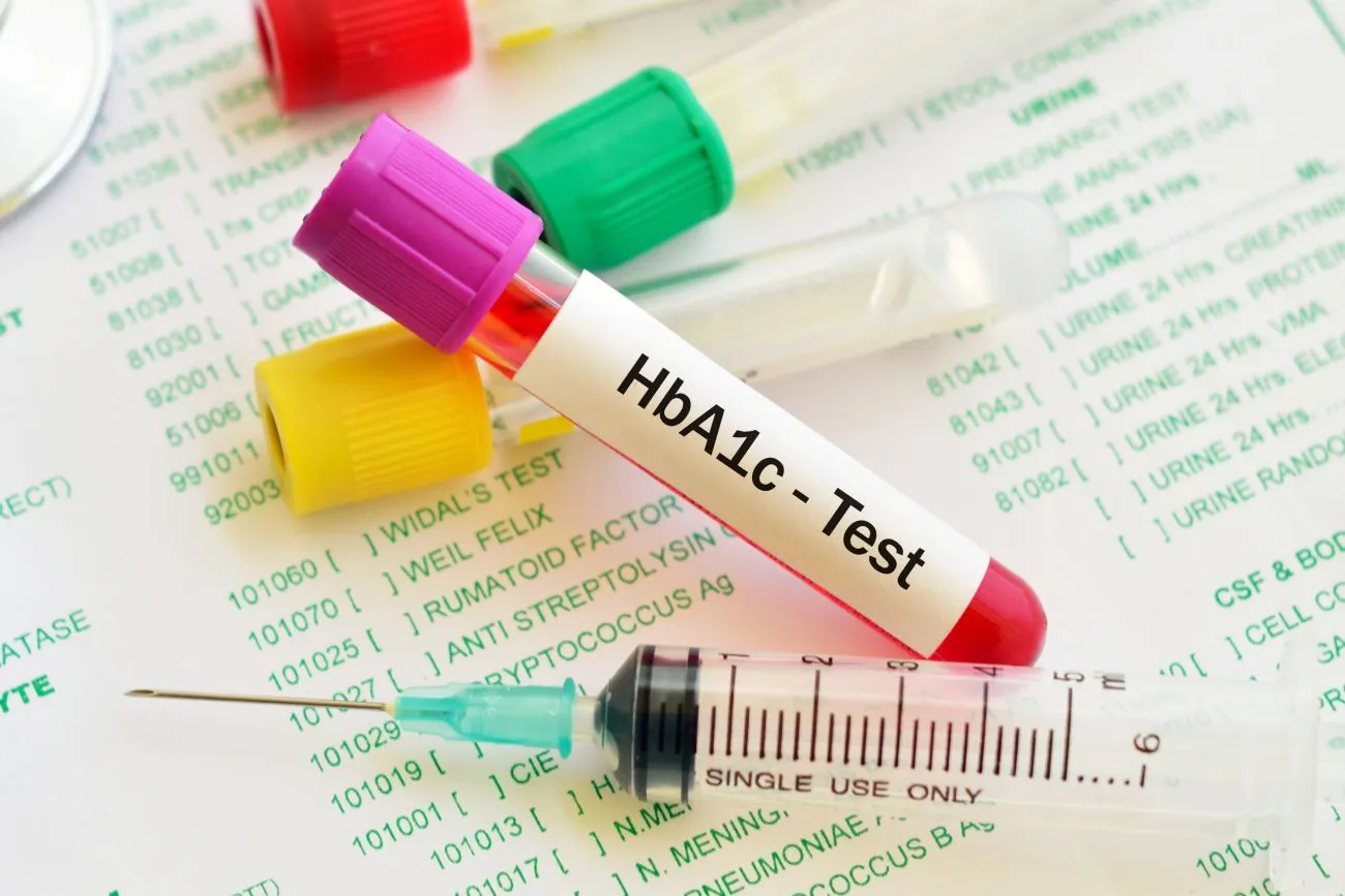 A1C Test for Diabetes: What You Need to Know