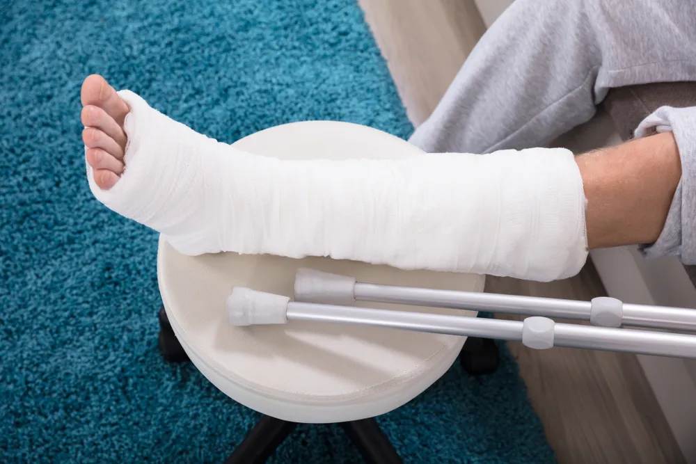 Is It a Fracture or a Break? How to Determine What’s Happened to Your Bones