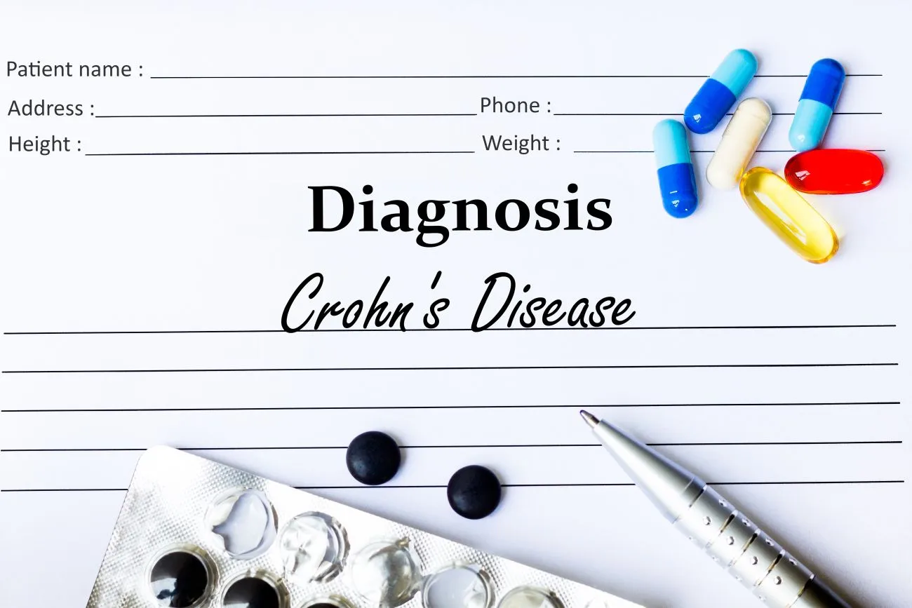 About Crohn’s Disease | FAQs