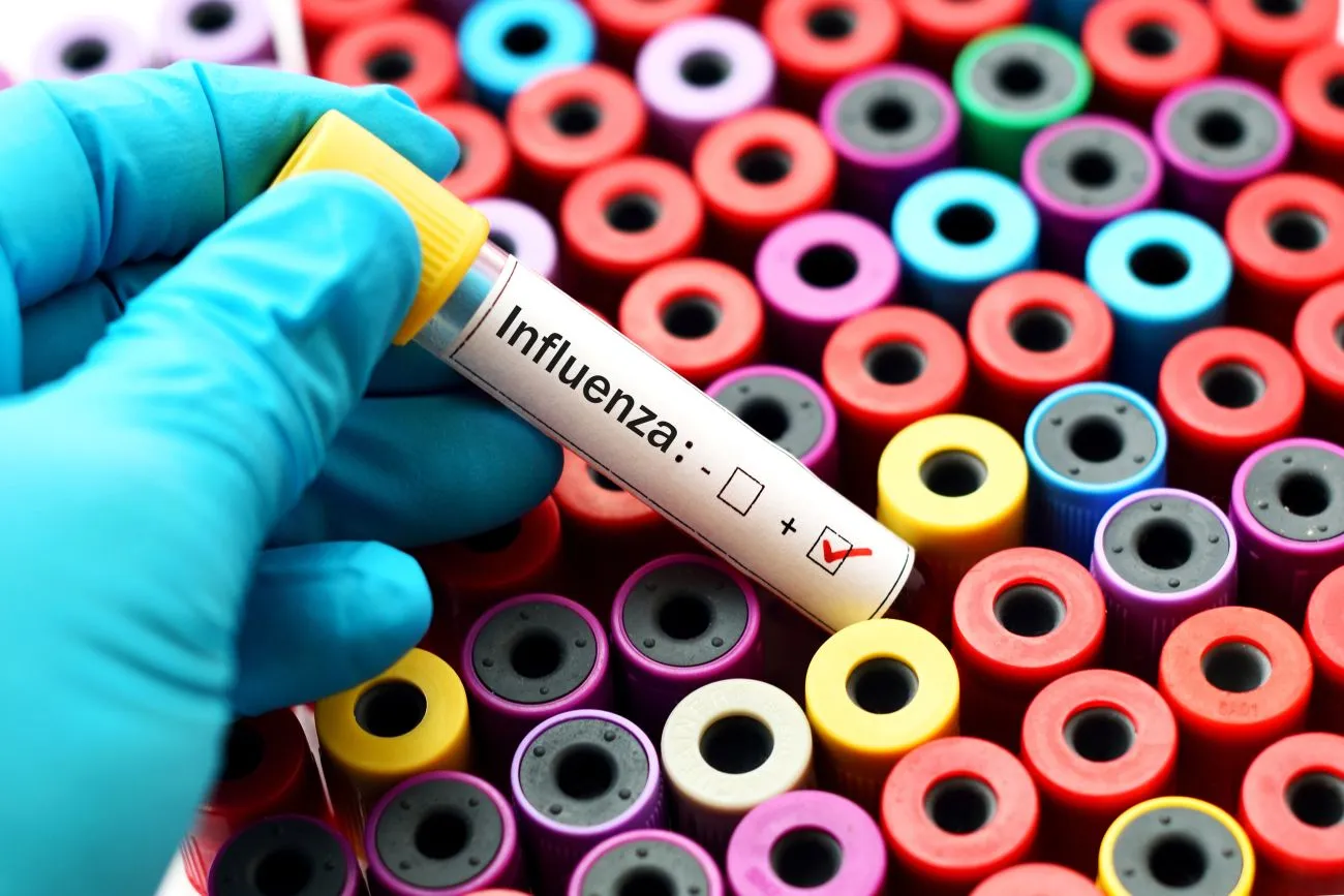 Everything You Need To Know About Influenza (Flu)