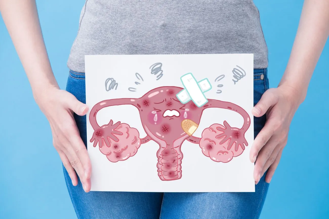 Everything You Need to Know About Ovarian Cancer