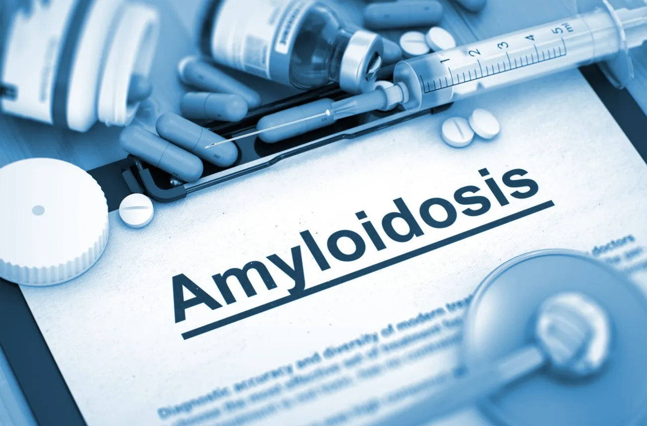 Everything You Need to Know About Amyloidosis