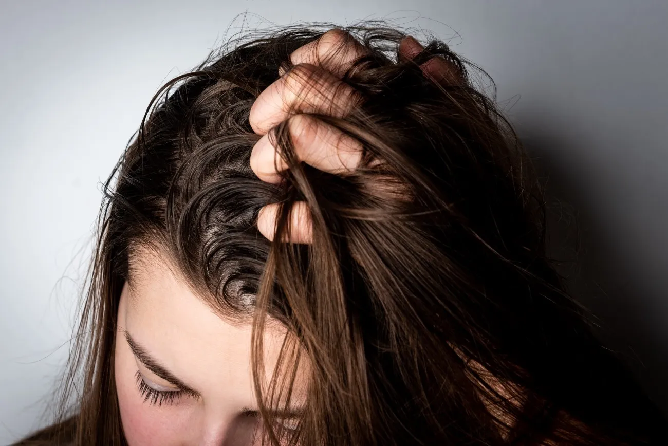 Best Affordable Medicated Shampoos for Scalp Psoriasis